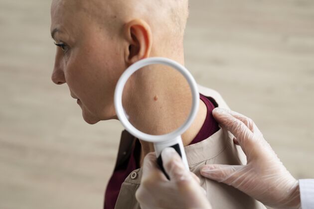 护理医生正在给一个皮肤癌病人做检查健康医学希望