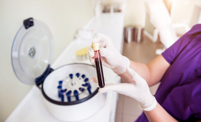 设备富血小板血浆制备管手上有血血清血浆科学