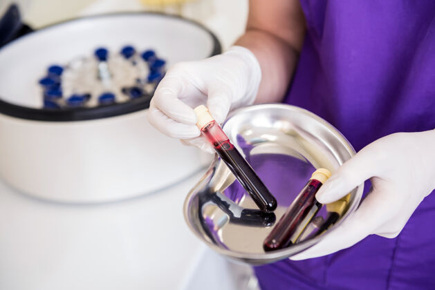 手富血小板血浆制备管手上有血技术人员研究药物