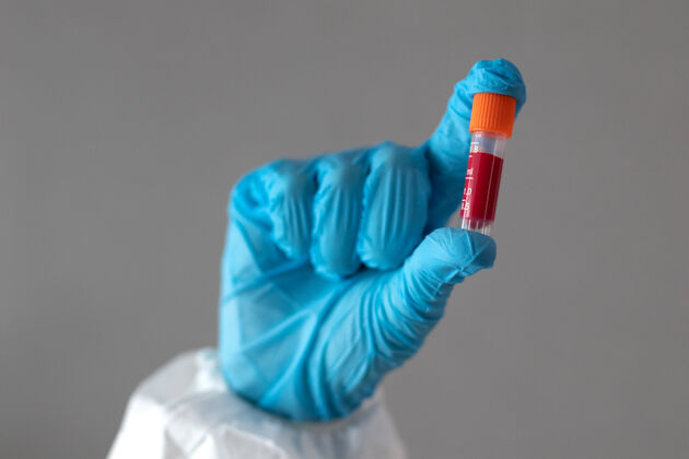 微生物学医生戴着医用手套的手显示试管里有血试管病毒大流行