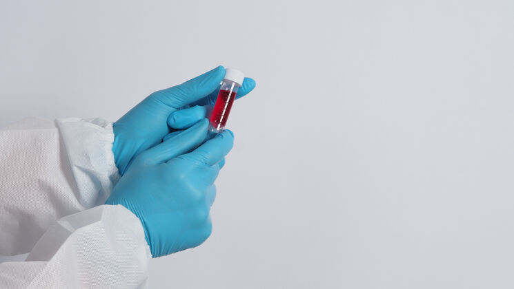 特写镜头血圆管19测试医生手拿血样管在实验室进行分析技术员戴着医用手套拿着血样管进行研究试管血浆病毒