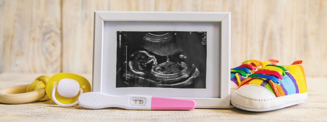 胎儿宝宝的超声波照片和配件未出生新生儿怀孕