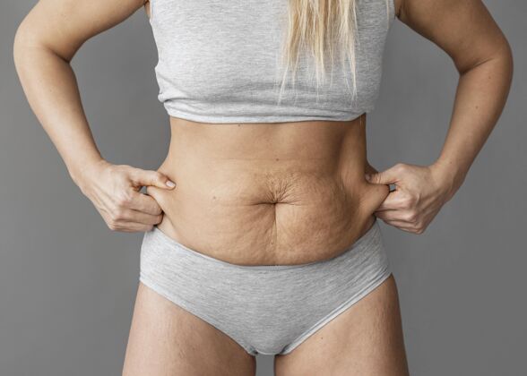 伤疤近距离拍摄腹部脂肪的女人肥胖积极积极