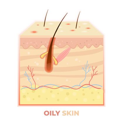 油性皮肤真实的油性皮肤层插图插图皮肤皮肤护理